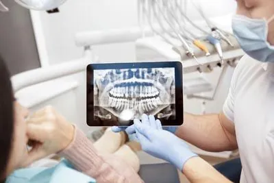3D digital X-rays used at iSmile Orthodontics to offer the best care for patients possible
