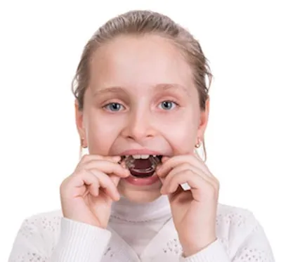 girl putting in her retainers she received from iSmile Orthodontics in San Ramon, CA